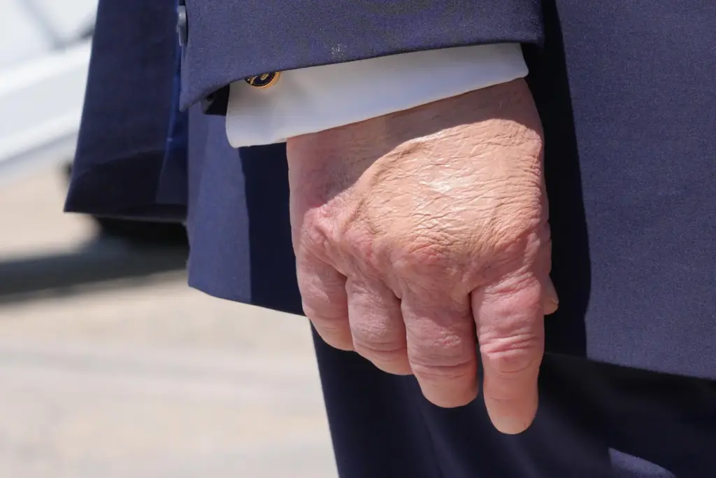 President Donald Trump's right hand is seen as he speaks to the press.