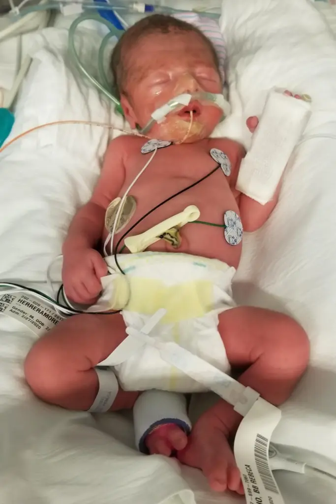 Nico hooked up to tubes in the hospital.