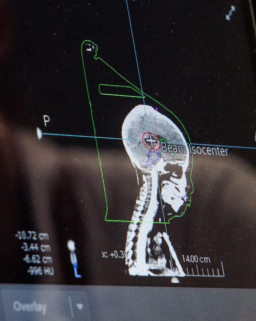 An image of patient Stephen De La Torre, 7, appears...