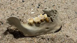 Human teeth, attached to lower jaw, found on San Clemente beach