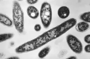 Legionnaires’ disease outbreak on NYC’s Upper East Side has now claimed five lives