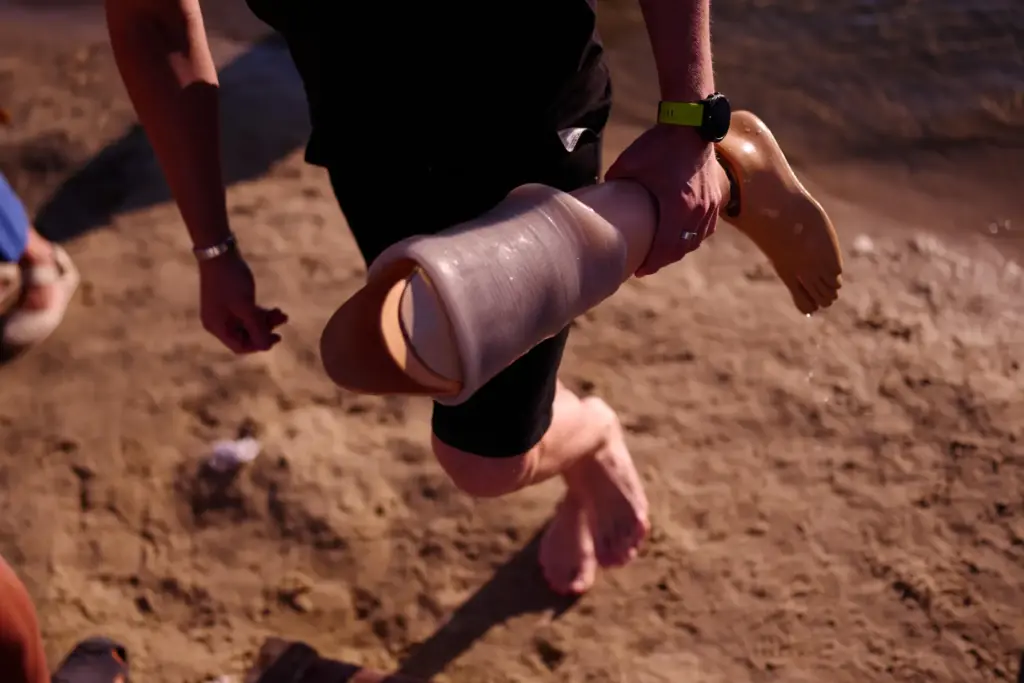 A friend holds the prosthetic leg of a Ukrainian war veteran.