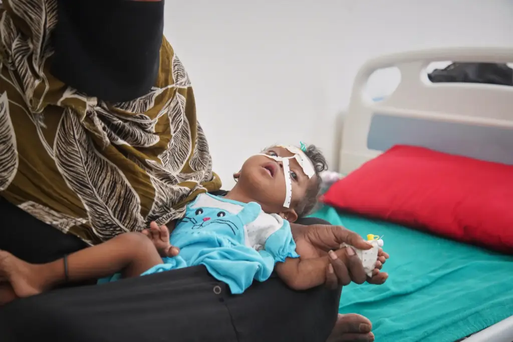 A woman holds a child showing symptoms of malnutrition while...