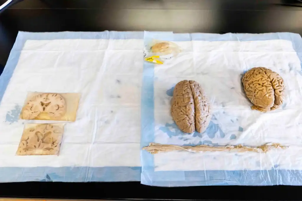 Cross sections and whole brains lie beside a spinal stem...