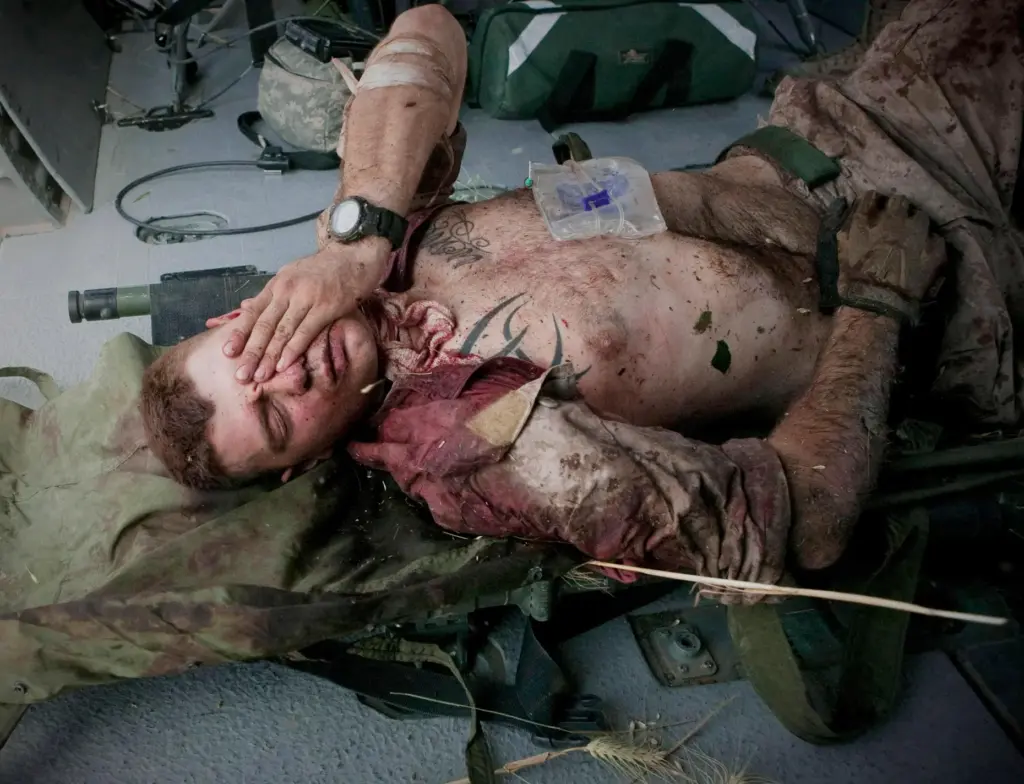 FILE – Injured U.S. Marine Cpl. Burness Britt reacts after...