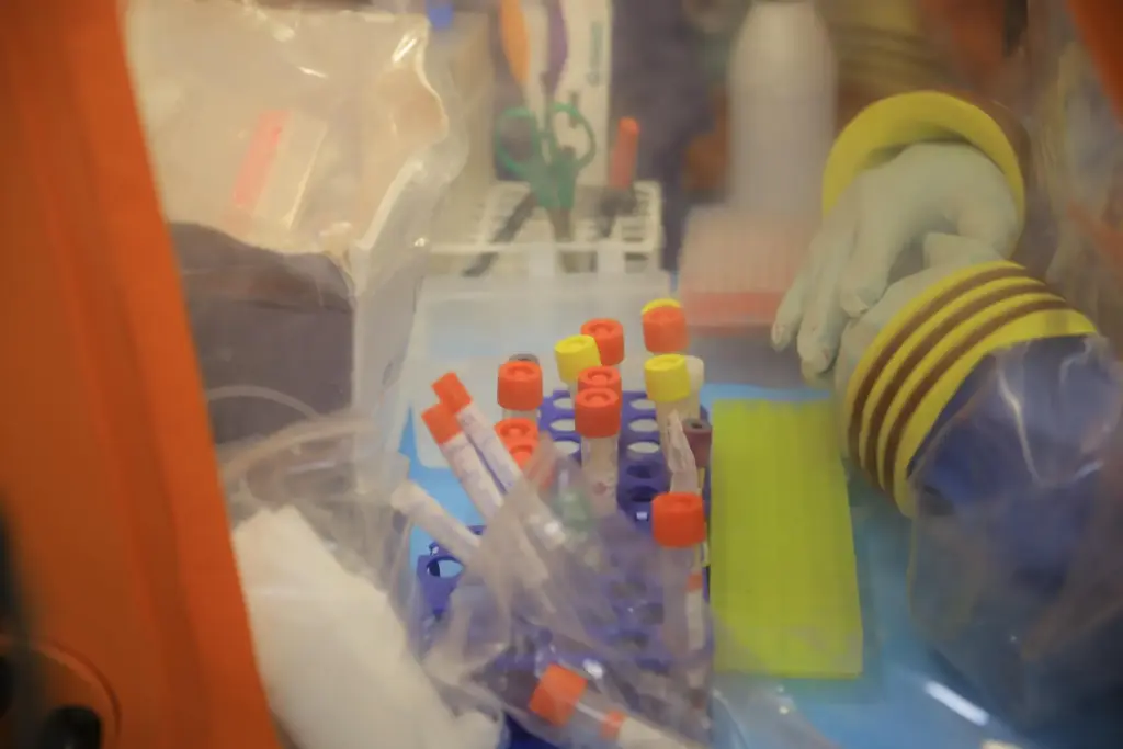 Tubes to collect blood samples are organized inside a mobile...