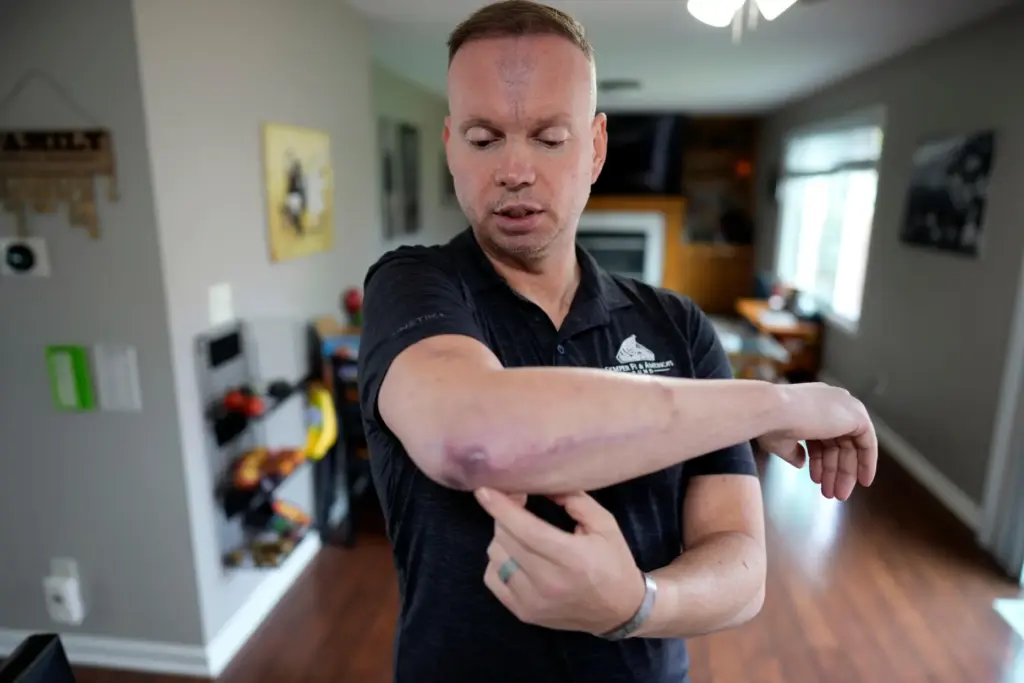 Lt. Col. Tim Halbur, who was injured in an Iranian...